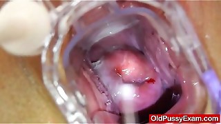 Gyno-tool action during a matured Gynecology